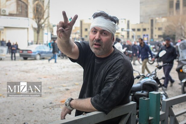 شهروندان مجروح حملات آمریکا و اسراییل در میدان فردوسی تهران