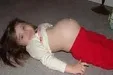 دختر ۱۱ ساله با درد معده راهی بیمارستان شد؛ زایید