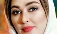 الهام حمیدی و دکتر زیبایی خوش چهره‌اش + عکس
