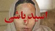 انتقام‌جویی با اسیدپاشی روی همسر و دختر
