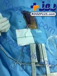 خروج میخ پنج سانتی از قلب جوانی ۲۱ ساله +عکس (۱۴+)