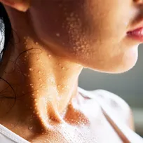 چرا عرق سرد می‌کنیم؟