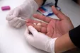 شناسایی مبتلایان به ویروس HIV در روستای چنار لردگان / اولویت جلوگیری از شیوع بیماری است‌