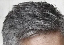 ۸ رازی که موها درباره‌ سلامتی بدن شما فاش می‌کنند