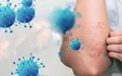 مهمترین علائم پوستی ابتلا به کرونا چیست؟
