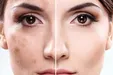 همه چیز درباره پاکسازی پوست صورت