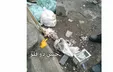 انتشار عکس جنین ۲ قلو‌ها در زباله‌های رشت / خیلی تکاندهنده