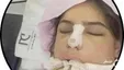مرگ مرموز سحر اسکندری بعد از عمل بینی داخل بیمارستان