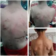 شلاق معلم ورزش بر بدن دانش‌آموز ۹ ساله +عکس