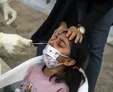 زالی: ۱۹.۵ درصد بستری‌ها در تهران، کودکان زیر ۱۰ سال هستند