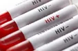تماس با ویروس ایدز می‌تواند باعث ابتلا به عفونت HIV شود / تماس‌های عادی روزمره باعث انتقال ویروس ایدز نمی‌شود
