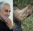تصویر منتسب به دست و انگشتر شهید سلیمانی پس از جنایت آمریکا