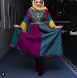 ژست متفاوت خانم بازیگر در جشنواره فجر +عکس