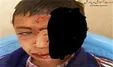افشای روایت واقعی سقوط دانش‌آموز قاینی به خاطر شبکه شاد +فیلم