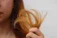 موخوره را با این مواد غذایی از بین ببرید
