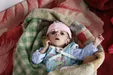 یک نوزاد یمنی دچار سوء تغذیه در بیمارستانی در شهر صنعا