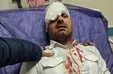 نابینا شدن پرسنل بیمارستان مسجدسلیمان در پی حمله همراه بیمار