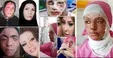 بررسی طرح تشدید مجازات اسیدپاشی در مجلس