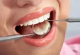 چگونه بوی بد دهان را با طب سنتی درمان کنیم؟